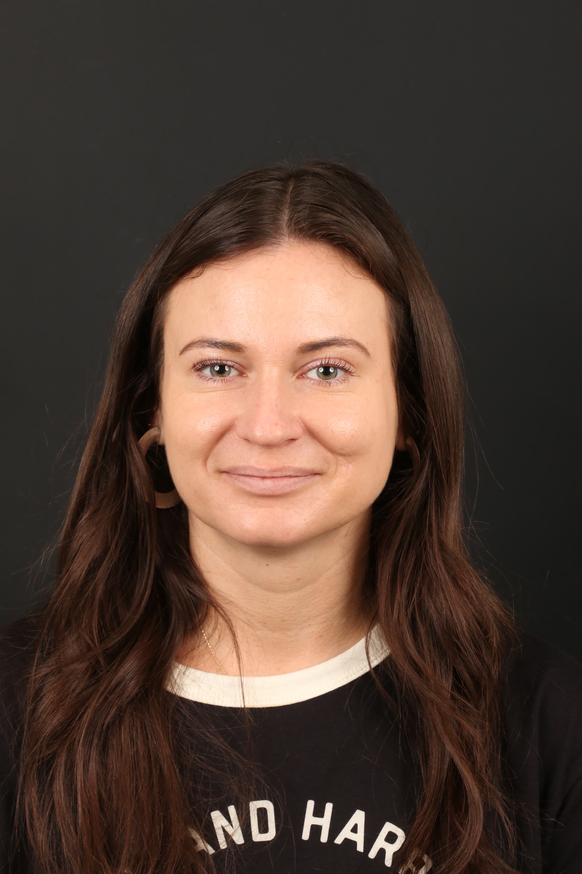 Four-month result after cheek mole removal with Molectomy