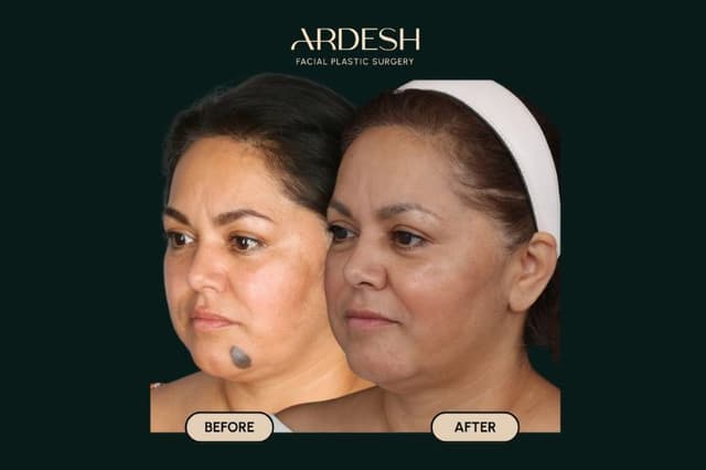Blog Featured Image