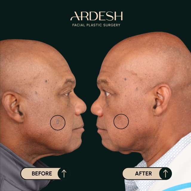 Blog Featured Image