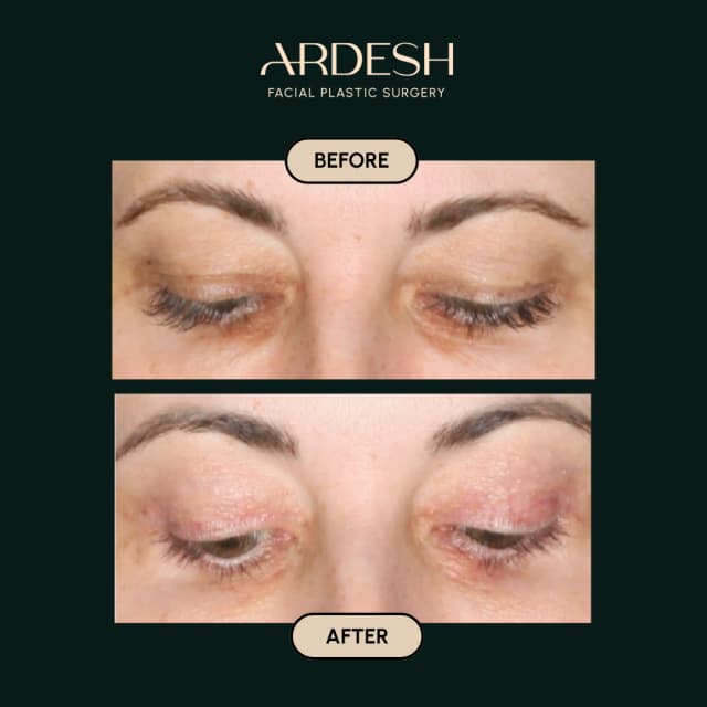 Blog Featured Image