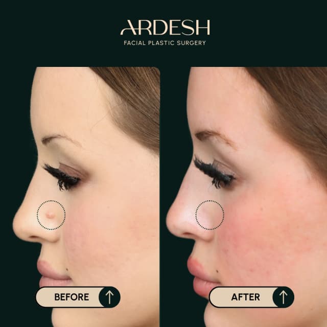 Blog Featured Image