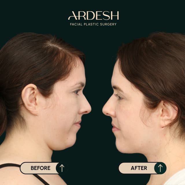 Blog Featured Image