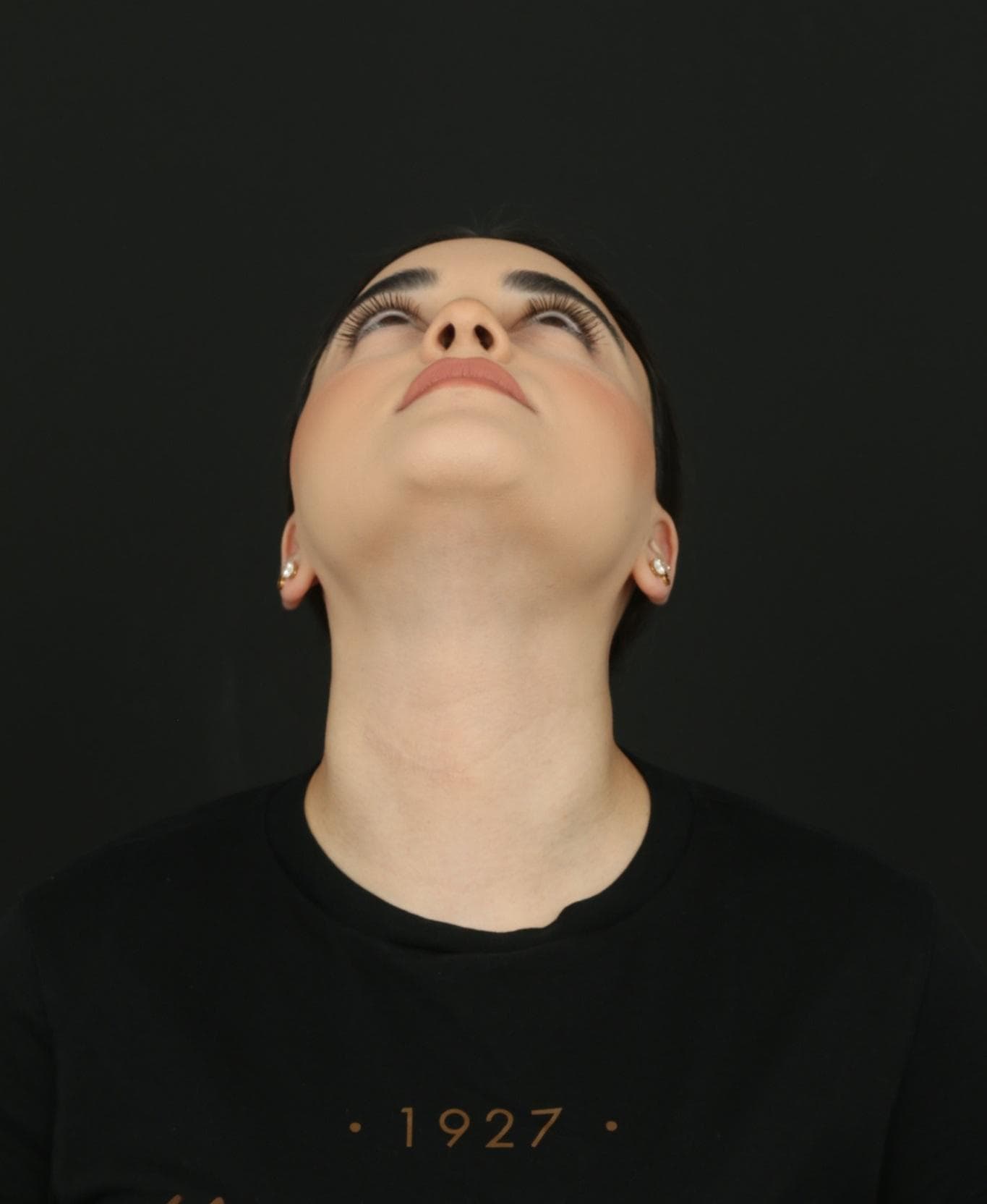 Six-month follow-up after Molectomy showing the healed lower neck treatment area