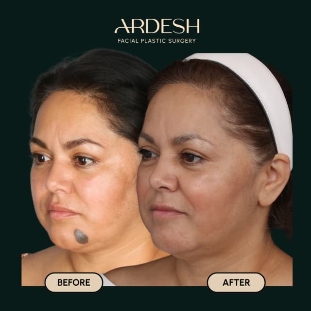 Blog Featured Image