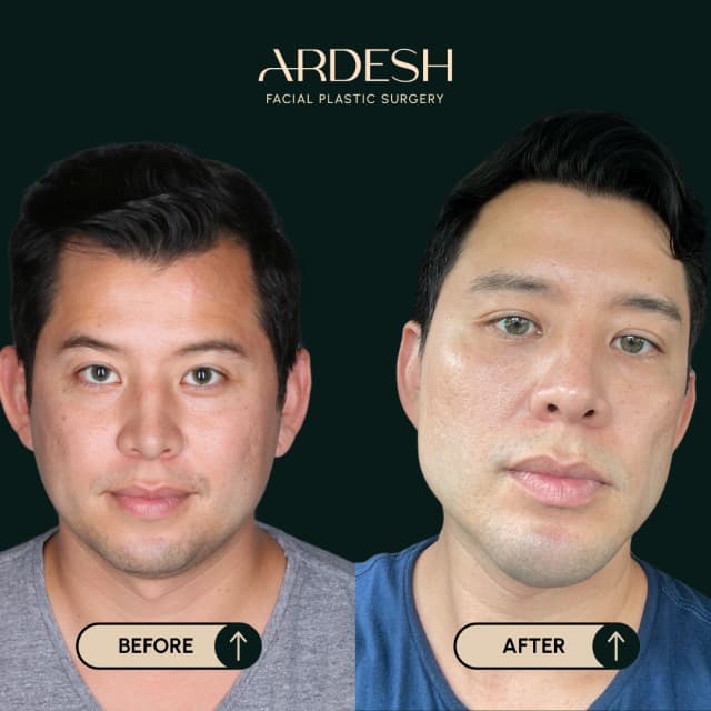 Blog Featured Image