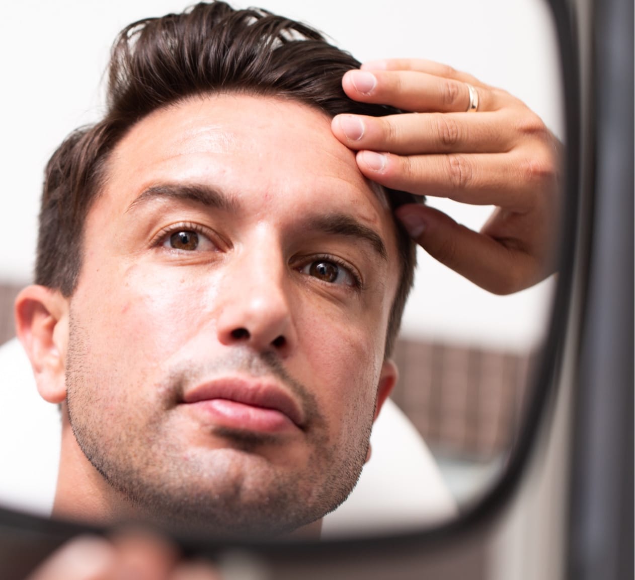 man looking in mirror at hairline