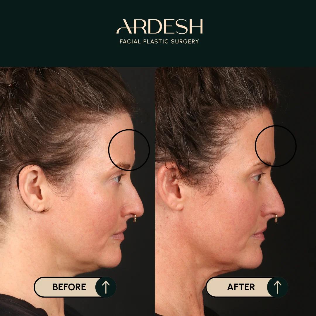 Transformation Image