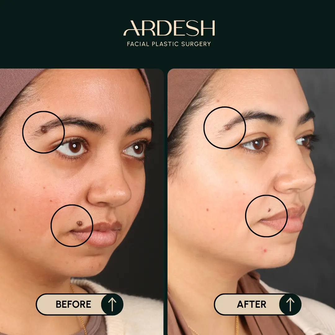 Transformation Image