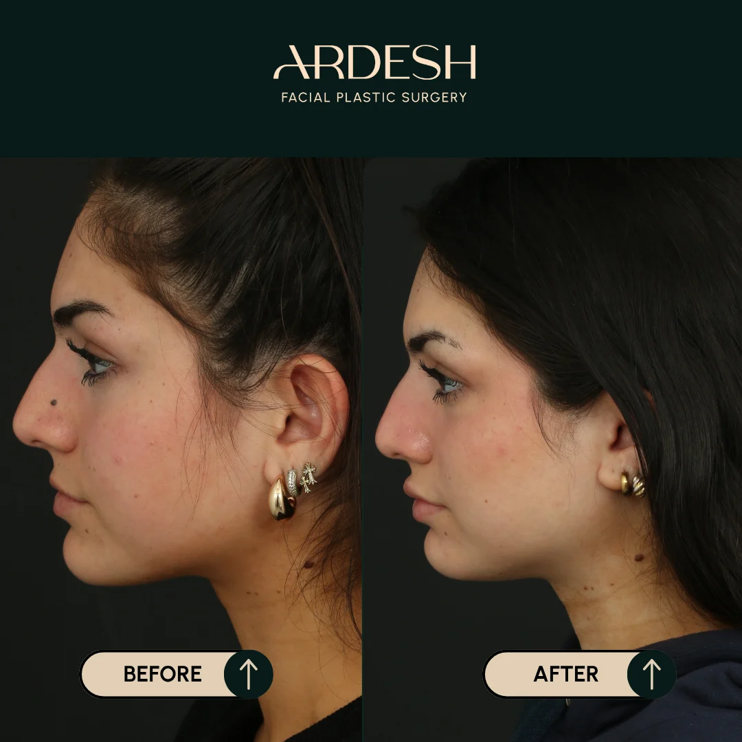 Transformation Image