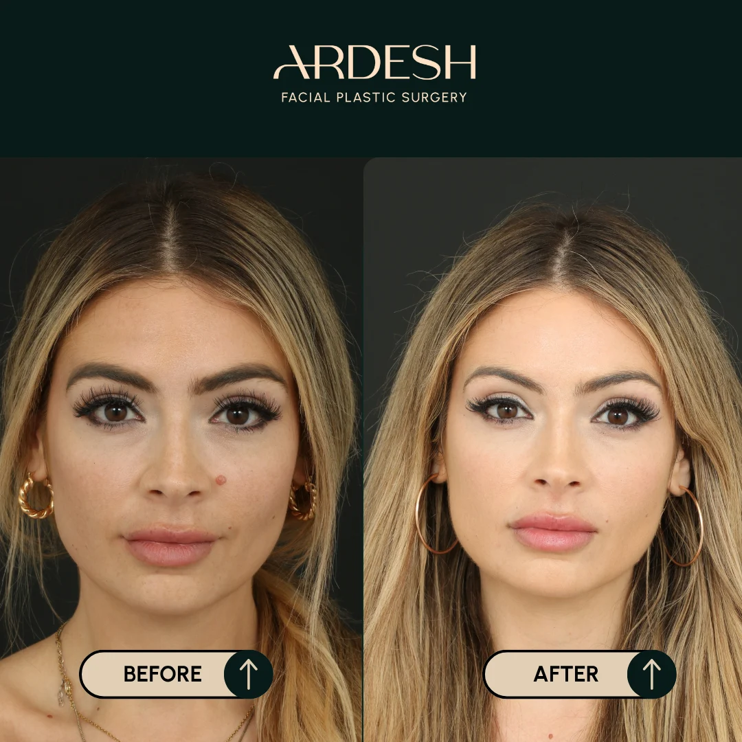 Transformation Image